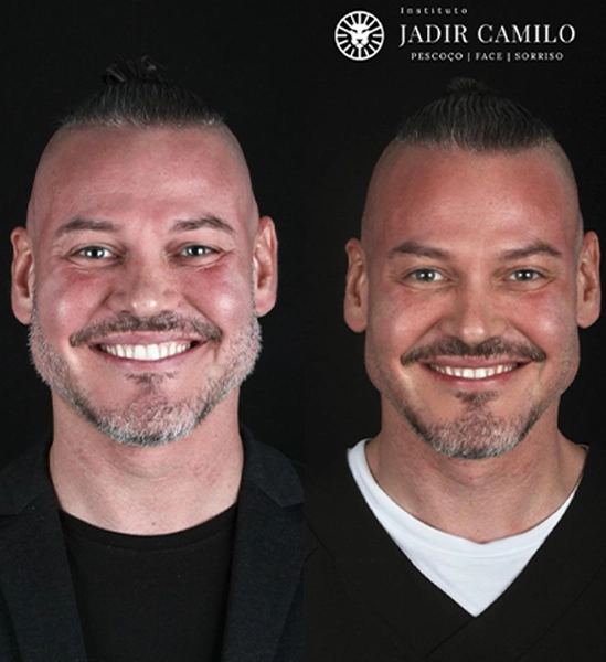 RESULTADO 1 - DR JADIR
